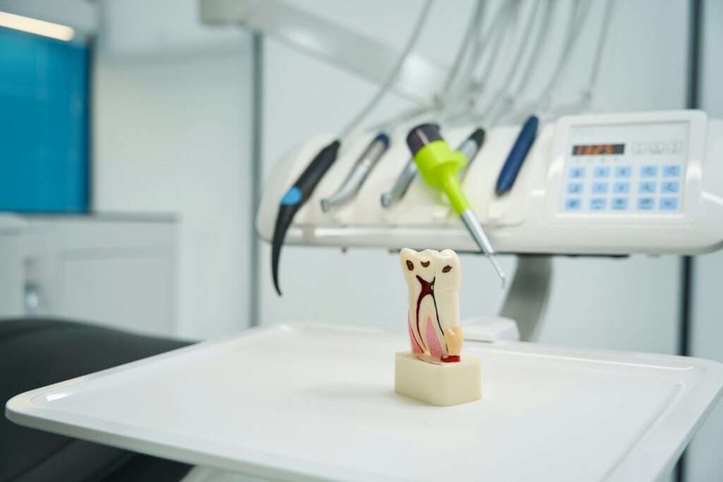 Tooth model displaying root canals and caries, illustrating dental decay and endodontic treatment for Wells Family Dental Group's Root Canal Awareness blog