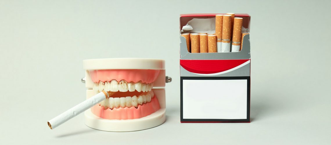 Oral cancer risk demonstration with cigarette in mouth model, highlighting smoking dangers, for Wells Family Dental Group's Oral Cancer Awareness